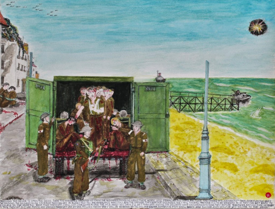 Ordering the driver to open the doors, then the moaning started up from the wounded. Groaning about their heads, legs, stomachs and arms. The floor was covered in blood about 2 inches thick overflowing onto the ground. The soldiers also covered themselves in blood. “I told you the ambulance was full,” said the driver. “They are not wounded, they are fakers, pretending to be wounded so as they can get back to England on the hospital ship. Take them off.”
“I will not.”
“ I am going to see the M.O. about you.”
“Then I’ll get them off.” Asking the soldiers what was wrong with them. They refused to answer saying I had no right to take them off so I used force and dragged them off one by one, telling them they will be examined by the M.O. One soldier suffering from shell shock had sucked away half of his thumb to the bone.